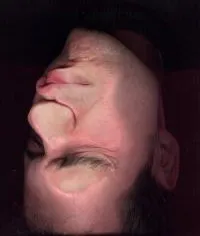 2007 — Gesichtsscan, Kopf falsch herum, geschlossene Augen, Gesicht partiell plattgedrückt, schwarzer Hintergrund